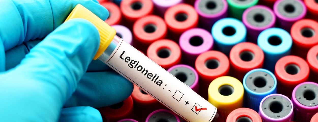A gloved hand pulls out a test tube labeled "Legionella"