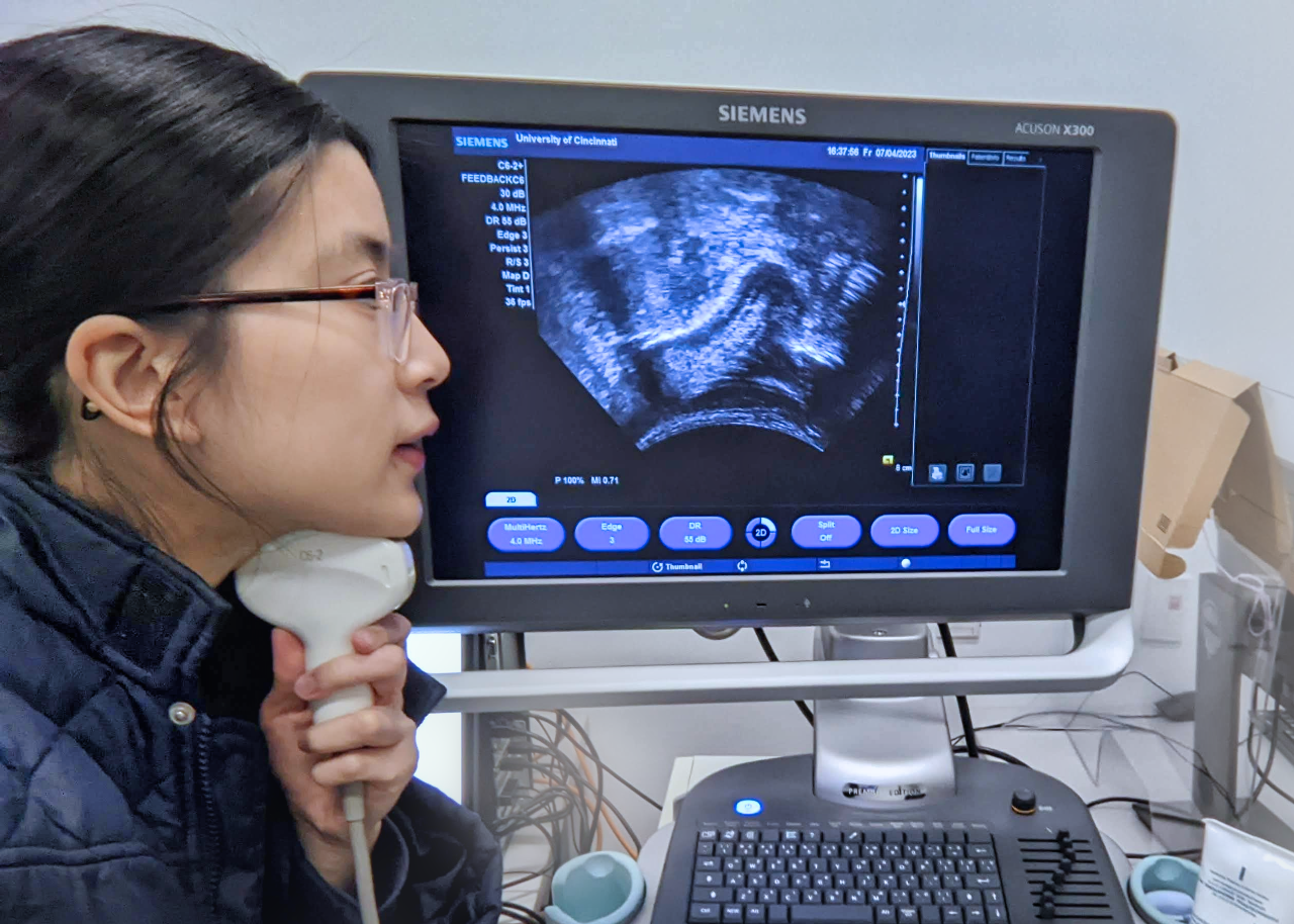 Sarah Li places ultrasound probe under her chin to see tongue surface on screen. 