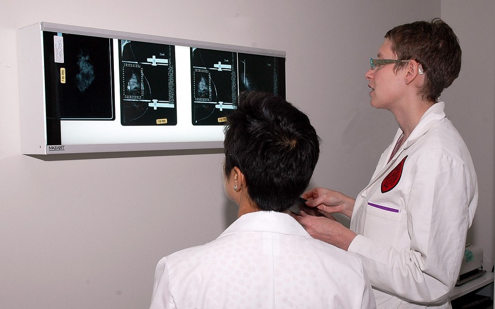 Surgeons Jennifer Manders, MD, (right) and Anureet Bajaj, MD, examine a breast cancer patient's mammograms.
