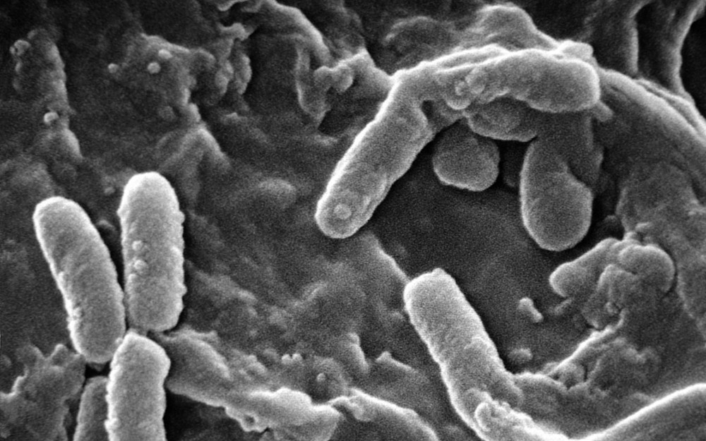 Pseudomonas aeruginosa, bacteria that affects cystic fibrosis patients