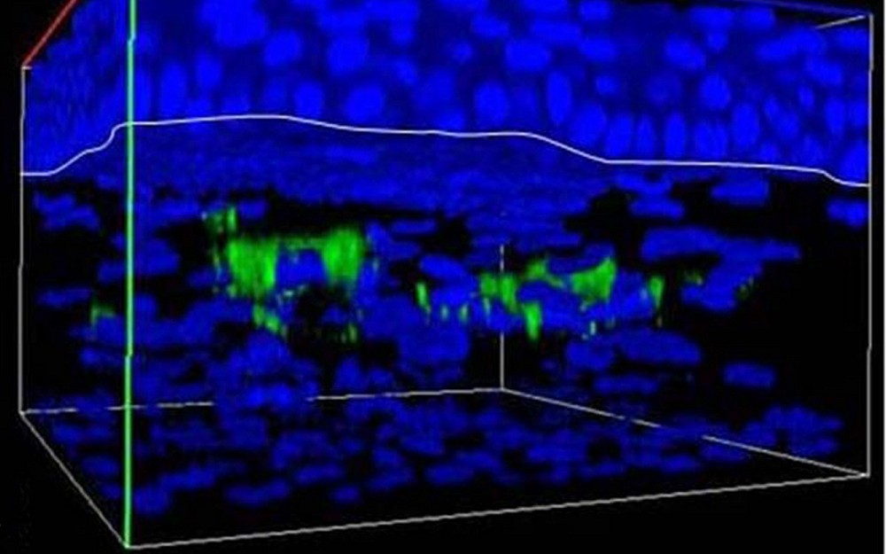The green in this diagram shows bone marrow stem cells that have been injected into the eye and have taken on the properties of corneal cells. After being injected, the stem cells begin expressing cornea-specific proteins. This technology could one day help cure genetic eye diseases. 