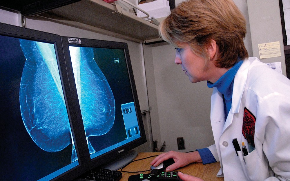 Mary Mahoney, MD, reviews a digital mammogram. 