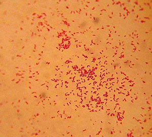 Stenotrophomonas maltophilia is the first bacterial species associated with higher ERMI values in homes.